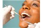 Tratamento para Restauração dos Dentes